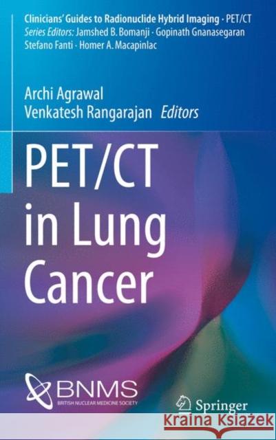 Pet/CT in Lung Cancer Agrawal, Archi 9783319726601 Springer