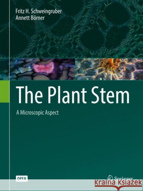 The Plant Stem: A Microscopic Aspect Schweingruber, Fritz H. 9783319735238