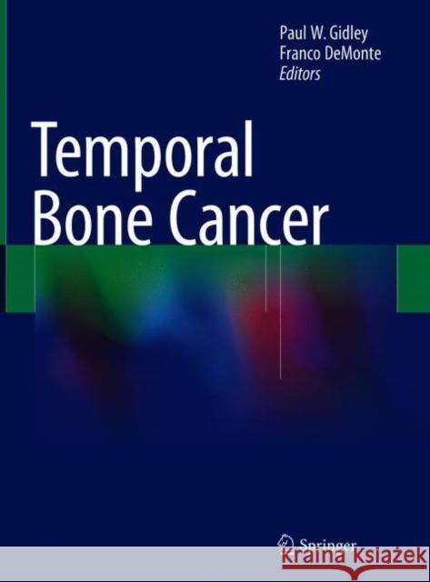 Temporal Bone Cancer Paul W. Gidley Franco DeMonte 9783319745381