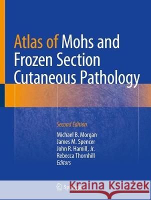 Atlas of Mohs and Frozen Section Cutaneous Pathology Michael B. Morgan James M. Spencer John R. Hamil 9783319748467 Springer