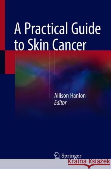 A Practical Guide to Skin Cancer Allison Hanlon 9783319749013 Springer