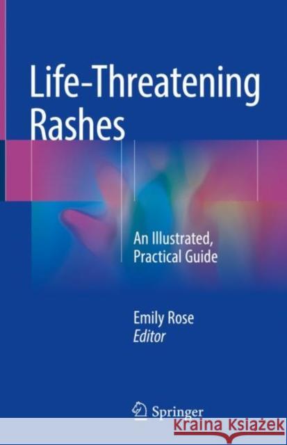 Life-Threatening Rashes: An Illustrated, Practical Guide Rose, Emily 9783319756226
