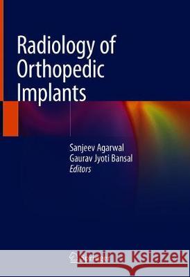 Radiology of Orthopedic Implants Sanjeev Agarwal Gaurav Jyoti Bansal 9783319760070