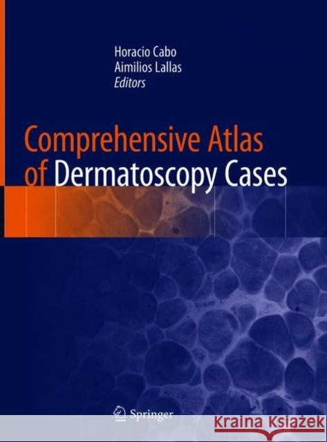 Comprehensive Atlas of Dermatoscopy Cases Horacio Cabo Aimilios Lallas 9783319769318 Springer