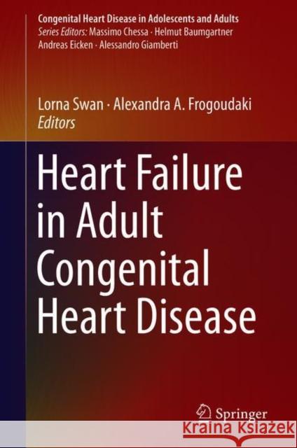 Heart Failure in Adult Congenital Heart Disease Lorna Swan Alexandra Frogoudaki 9783319778020 Springer