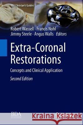 Extra-Coronal Restorations: Concepts and Clinical Application Wassell, Robert 9783319790923 Springer