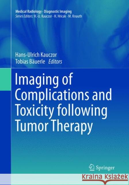 Imaging of Complications and Toxicity Following Tumor Therapy Kauczor, Hans-Ulrich 9783319791845 Springer International Publishing AG