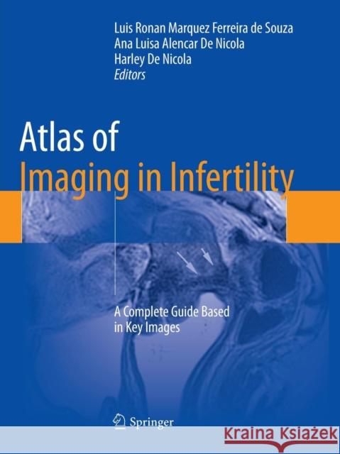 Atlas of Imaging in Infertility: A Complete Guide Based in Key Images De Souza, Luis Ronan Marquez Ferreira 9783319791913
