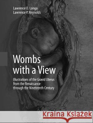 Wombs with a View: Illustrations of the Gravid Uterus from the Renaissance Through the Nineteenth Century Longo, Lawrence D. 9783319795003 Springer