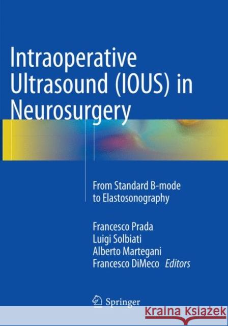 Intraoperative Ultrasound (Ious) in Neurosurgery: From Standard B-Mode to Elastosonography Prada, Francesco 9783319797595 Springer