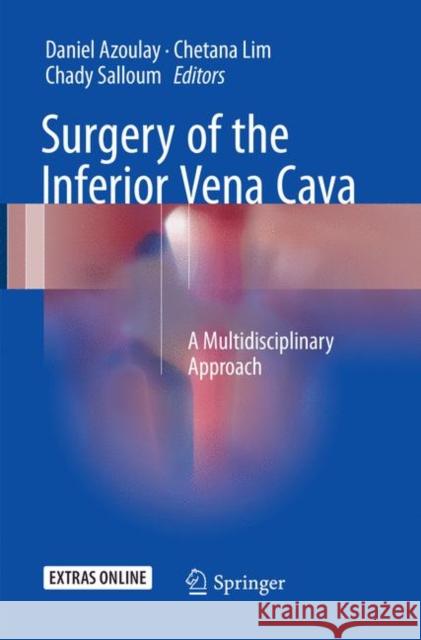 Surgery of the Inferior Vena Cava: A Multidisciplinary Approach Azoulay, Daniel 9783319798103 Springer