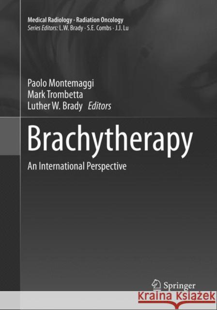 Brachytherapy: An International Perspective Montemaggi, Paolo 9783319800141 Springer