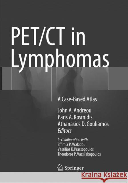 PET/CT in Lymphomas: A Case-Based Atlas Andreou, John a. 9783319801261 Springer