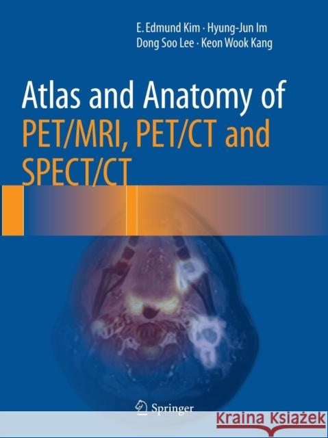 Atlas and Anatomy of Pet/Mri, Pet/CT and Spect/CT Kim, E. Edmund 9783319803999 Springer