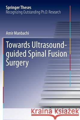 Towards Ultrasound-Guided Spinal Fusion Surgery Manbachi, Amir 9783319806648 Springer