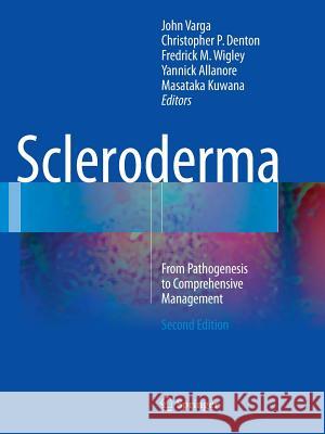 Scleroderma: From Pathogenesis to Comprehensive Management Varga, John 9783319810331 Springer