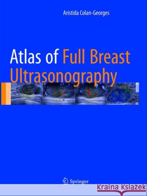 Atlas of Full Breast Ultrasonography Colan-Georges, Aristida 9783319810362 Springer