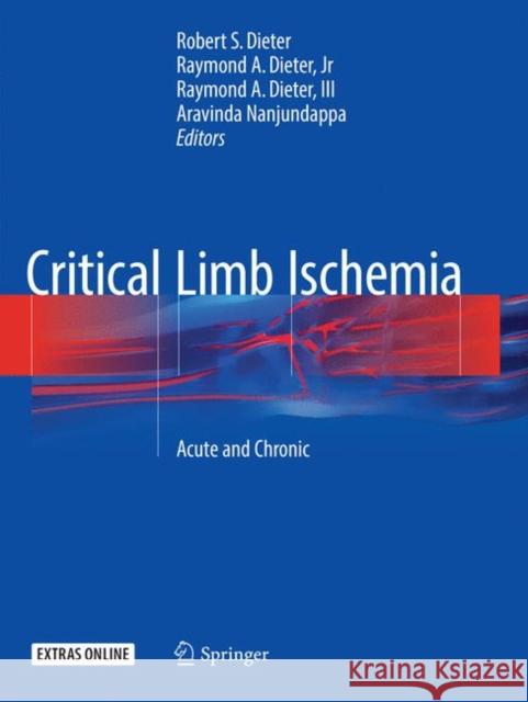 Critical Limb Ischemia: Acute and Chronic Dieter, Robert S. 9783319811710