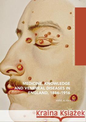 Medicine, Knowledge and Venereal Diseases in England, 1886-1916 Anne R. Hanley 9783319812908