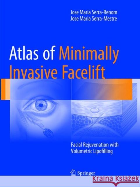 Atlas of Minimally Invasive Facelift: Facial Rejuvenation with Volumetric Lipofilling Serra-Renom, Jose Maria 9783319814230 Springer