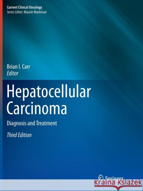 Hepatocellular Carcinoma: Diagnosis and Treatment Carr, Brian I. 9783319817057 Springer