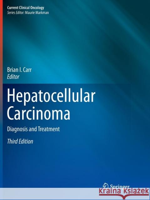 Hepatocellular Carcinoma: Diagnosis and Treatment Carr, Brian I. 9783319817057