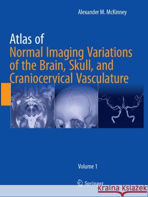 Atlas of Normal Imaging Variations of the Brain, Skull, and Craniocervical Vasculature Alexander M. McKinney 9783319819686 Springer