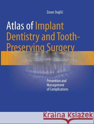 Atlas of Implant Dentistry and Tooth-Preserving Surgery: Prevention and Management of Complications Stajčic, Zoran 9783319825038 Springer