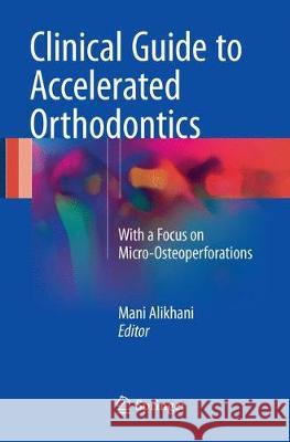 Clinical Guide to Accelerated Orthodontics: With a Focus on Micro-Osteoperforations Alikhani, Mani 9783319828138 Springer