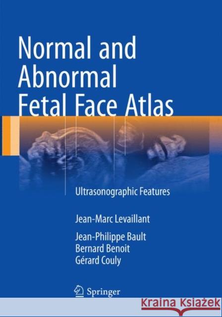 Normal and Abnormal Fetal Face Atlas: Ultrasonographic Features Levaillant, Jean-Marc 9783319829067 Springer