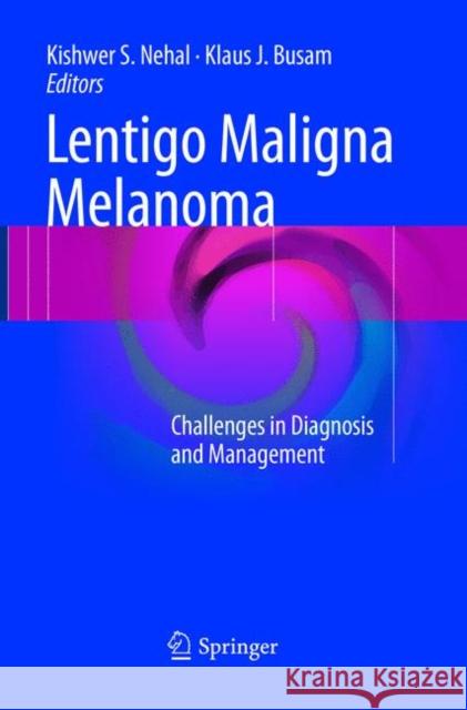 Lentigo Maligna Melanoma: Challenges in Diagnosis and Management Nehal, Kishwer S. 9783319829104 Springer