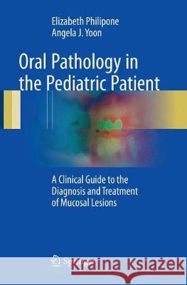 Oral Pathology in the Pediatric Patient: A Clinical Guide to the Diagnosis and Treatment of Mucosal Lesions Philipone, Elizabeth 9783319831008