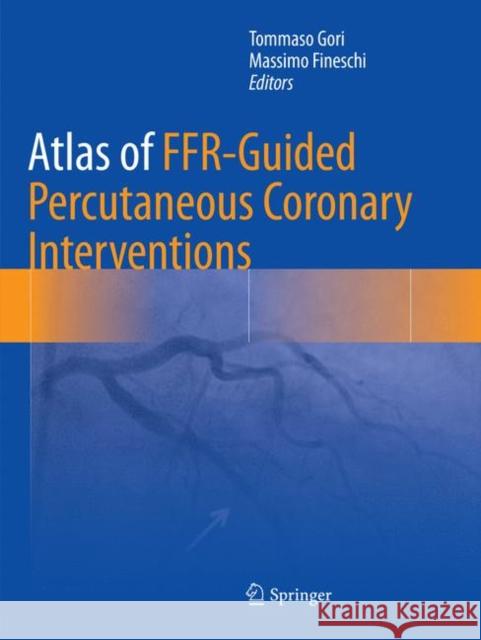 Atlas of Ffr-Guided Percutaneous Coronary Interventions Gori, Tommaso 9783319836607 Springer