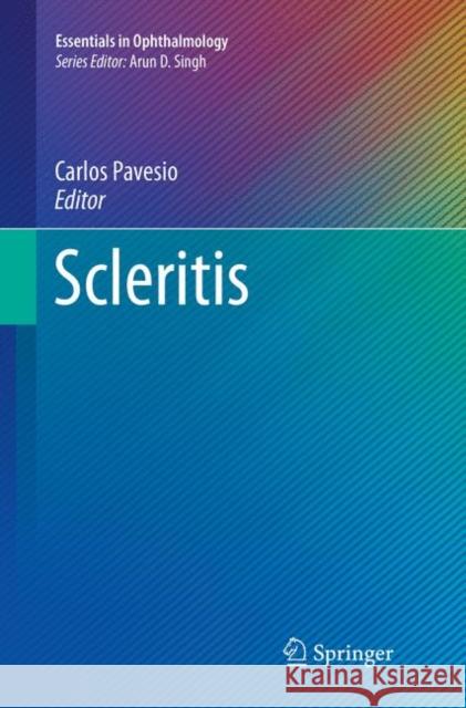 Scleritis Carlos Pavesio 9783319842721 Springer