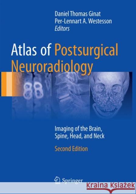 Atlas of Postsurgical Neuroradiology: Imaging of the Brain, Spine, Head, and Neck Ginat, Daniel Thomas 9783319848792 Springer