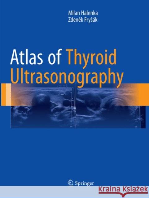 Atlas of Thyroid Ultrasonography Milan Halenka Zdeněk Frysak 9783319852379 Springer