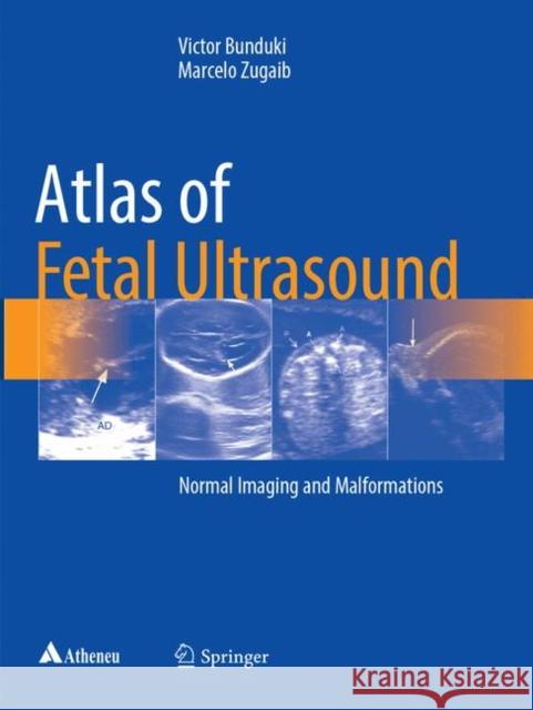 Atlas of Fetal Ultrasound: Normal Imaging and Malformations Bunduki, Victor 9783319854854 Springer