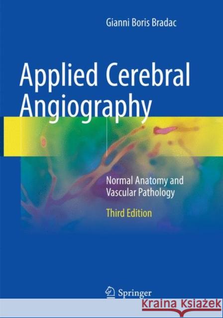 Applied Cerebral Angiography: Normal Anatomy and Vascular Pathology Boccardi, Edoardo 9783319861074 Springer
