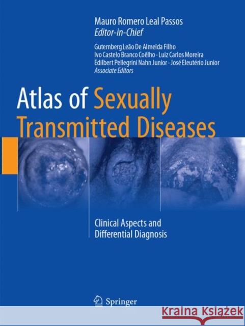 Atlas of Sexually Transmitted Diseases: Clinical Aspects and Differential Diagnosis Passos, Mauro Romero Leal 9783319861708 Springer