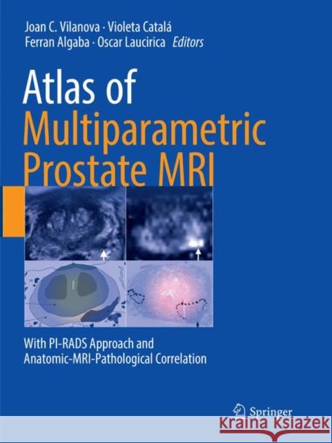 Atlas of Multiparametric Prostate MRI: With Pi-Rads Approach and Anatomic-Mri-Pathological Correlation Vilanova, Joan C. 9783319871639 Springer