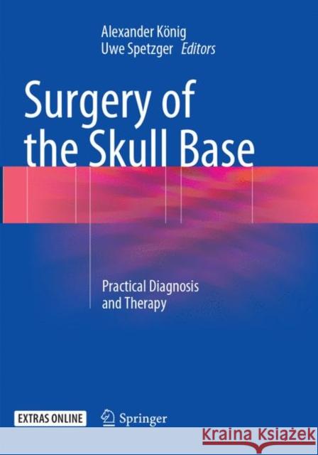 Surgery of the Skull Base: Practical Diagnosis and Therapy König, Alexander 9783319877013