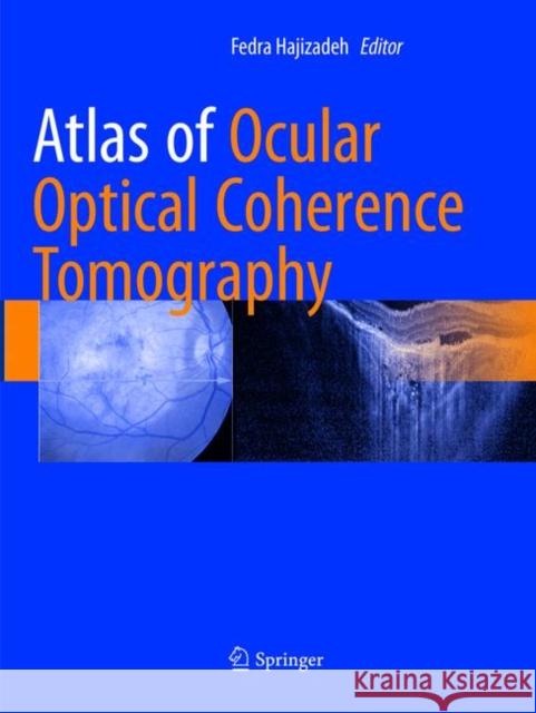 Atlas of Ocular Optical Coherence Tomography Fedra Hajizadeh 9783319883144 Springer