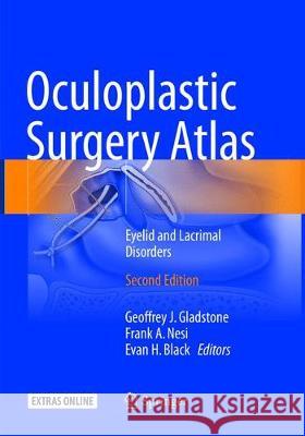 Oculoplastic Surgery Atlas: Eyelid and Lacrimal Disorders Gladstone, Geoffrey J. 9783319884141 Springer