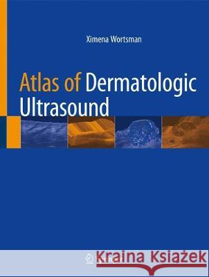 Atlas of Dermatologic Ultrasound Ximena Wortsman 9783319896137