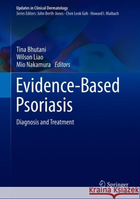 Evidence-Based Psoriasis: Diagnosis and Treatment Bhutani, Tina 9783319901060