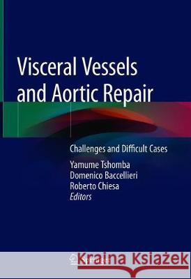 Visceral Vessels and Aortic Repair: Challenges and Difficult Cases Tshomba, Yamume 9783319947600 Springer