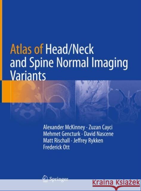 Atlas of Head/Neck and Spine Normal Imaging Variants Alexander McKinney Zuzan Cayci Mehmet Gencturk 9783319954400 Springer
