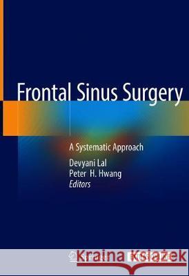 Frontal Sinus Surgery: A Systematic Approach Lal, Devyani 9783319970219 Springer
