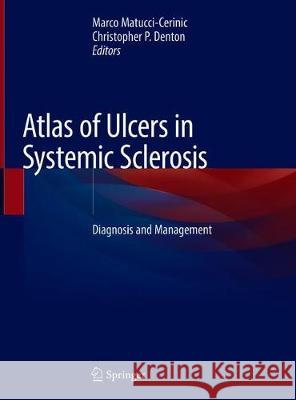 Atlas of Ulcers in Systemic Sclerosis: Diagnosis and Management Matucci-Cerinic, Marco 9783319984759 Springer