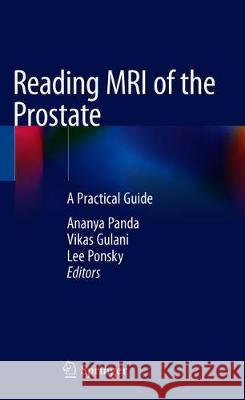 Reading MRI of the Prostate: A Practical Guide Panda, Ananya 9783319993553 Springer